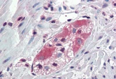 Immunohistochemistry-Paraffin: TXLNB Antibody [NBP3-14511]